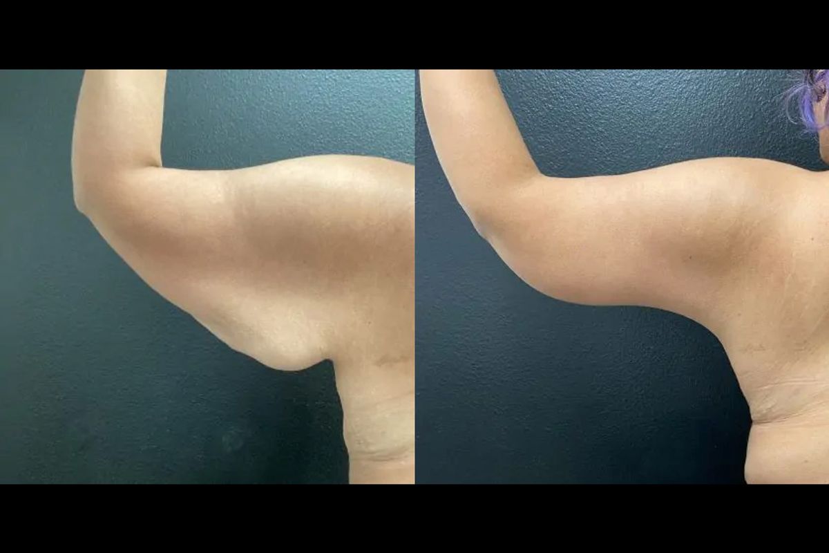New Life Cosmetic Surgery and Wellness Center, med spa and aesthetic clinic in McAllen