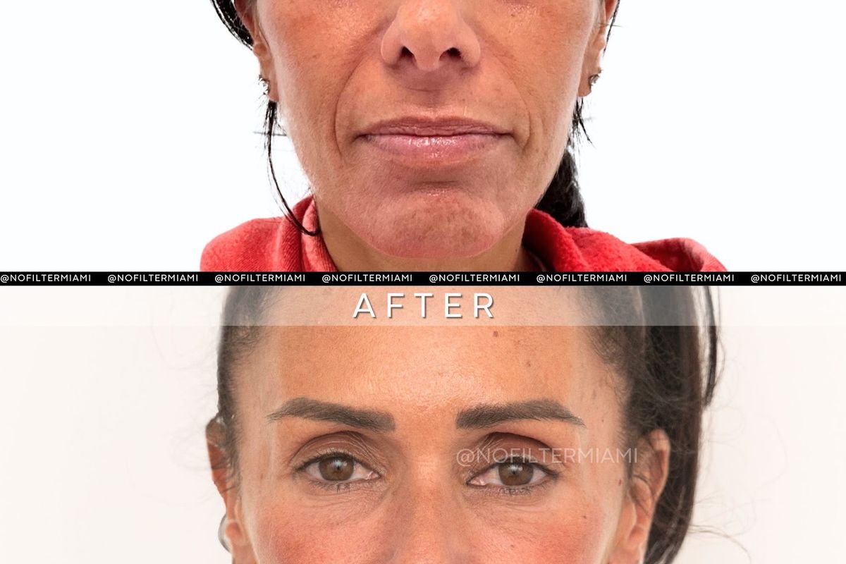 No Filter Medical Spa — Miami