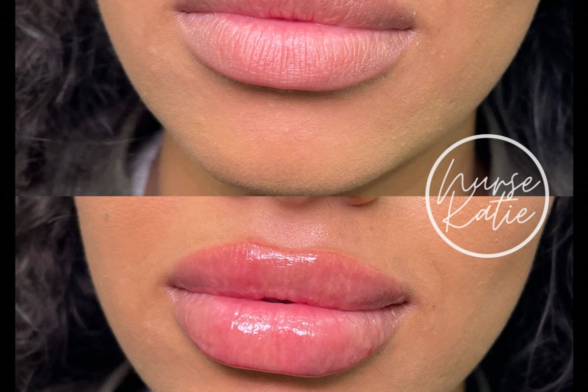 Nurse Katie Injectables, med spa and aesthetic clinic in Windsor