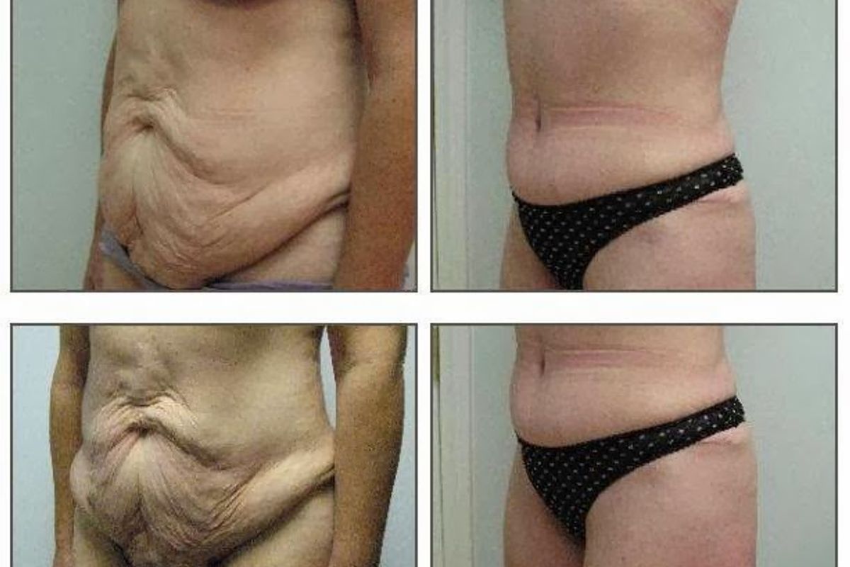 Pickart Plastic Surgery, med spa and aesthetic clinic in Ventura