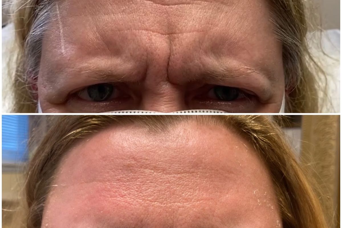 Prolase Medispa - Fairfax, med spa and aesthetic clinic in Fairfax