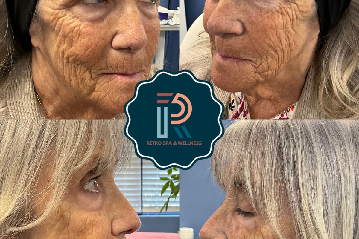 Retro Spa & Wellness, PLLC, med spa and aesthetic clinic in Fayetteville