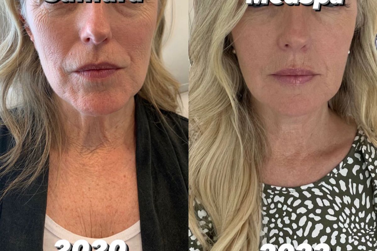 Samara MedSpa Avon, med spa and aesthetic clinic in West Hartford