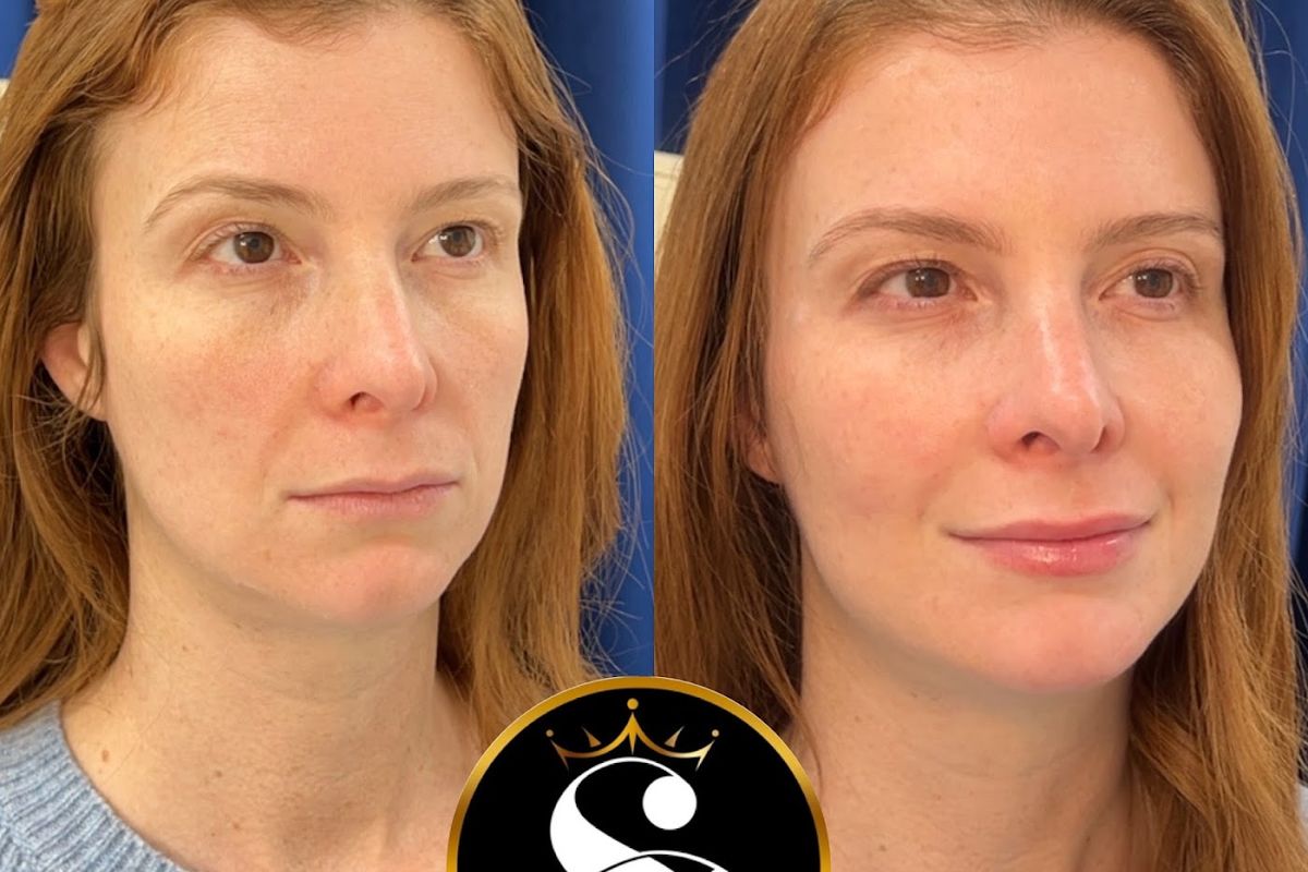 Shimaa Beauty Center Arlington, med spa and aesthetic clinic in Arlington