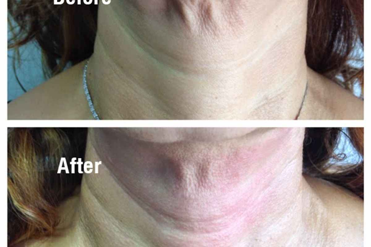 Simply Skin Laser Medispa, med spa and aesthetic clinic in Yonkers