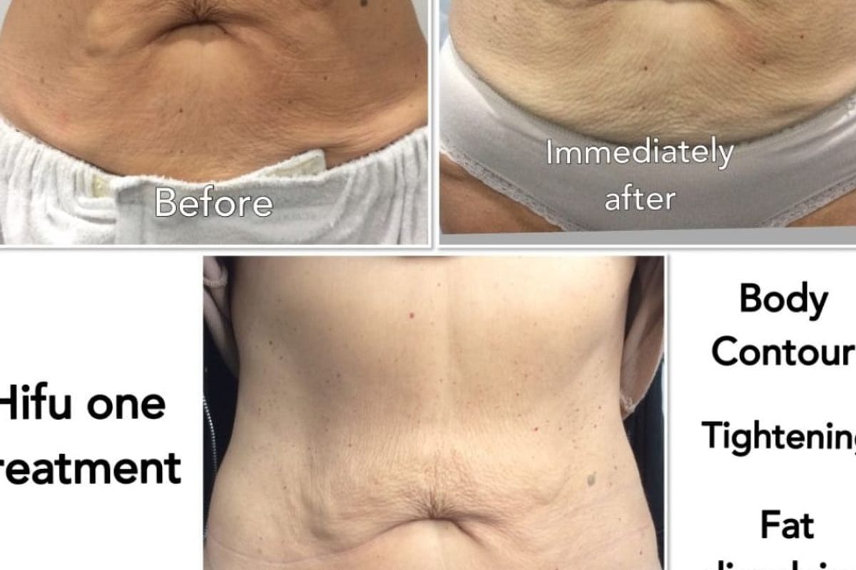 Skin Addicts Med Spa, med spa and aesthetic clinic in Grand Junction