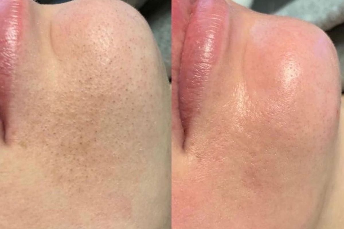 Skin Glow Medspa, med spa and aesthetic clinic in Fort Worth