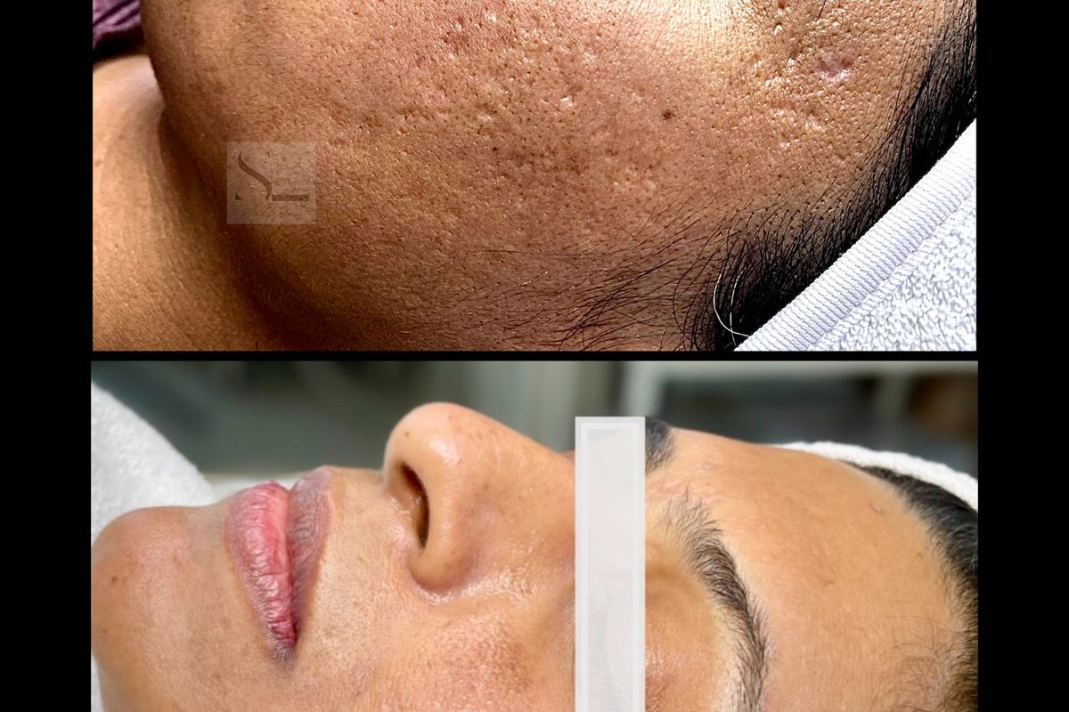 SkinLand MediSpa, med spa and aesthetic clinic in Burlington