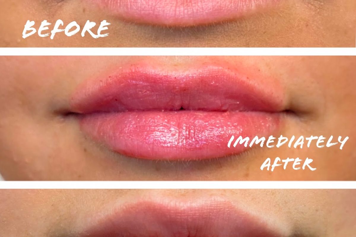 Skintuition Medical Aesthetics, med spa and aesthetic clinic in Pocatello