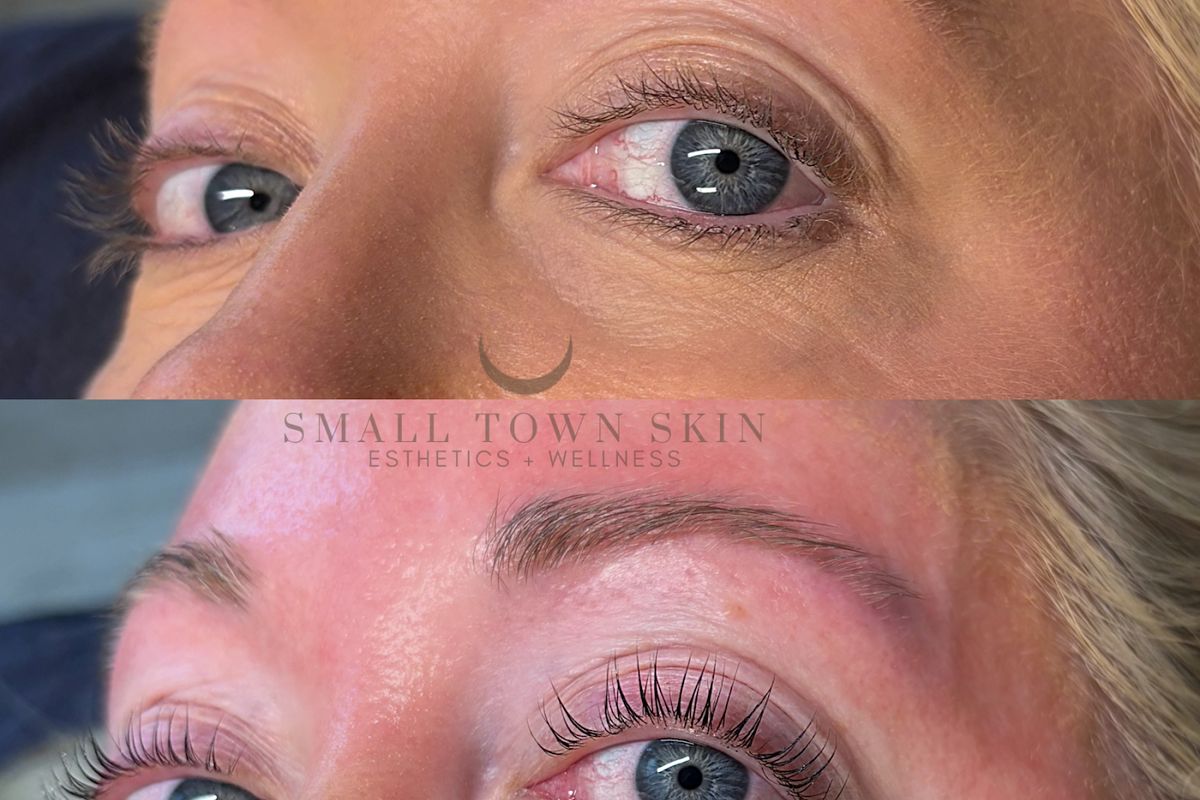 Small Town Skin Esthetics and Wellness, med spa and aesthetic clinic in Roanoke