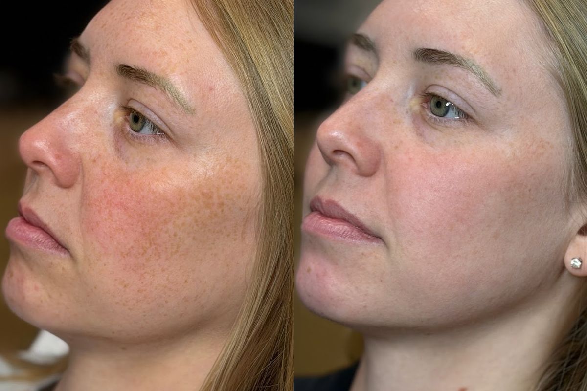Symmetry Aesthetics and Wellness, med spa and aesthetic clinic in Norman