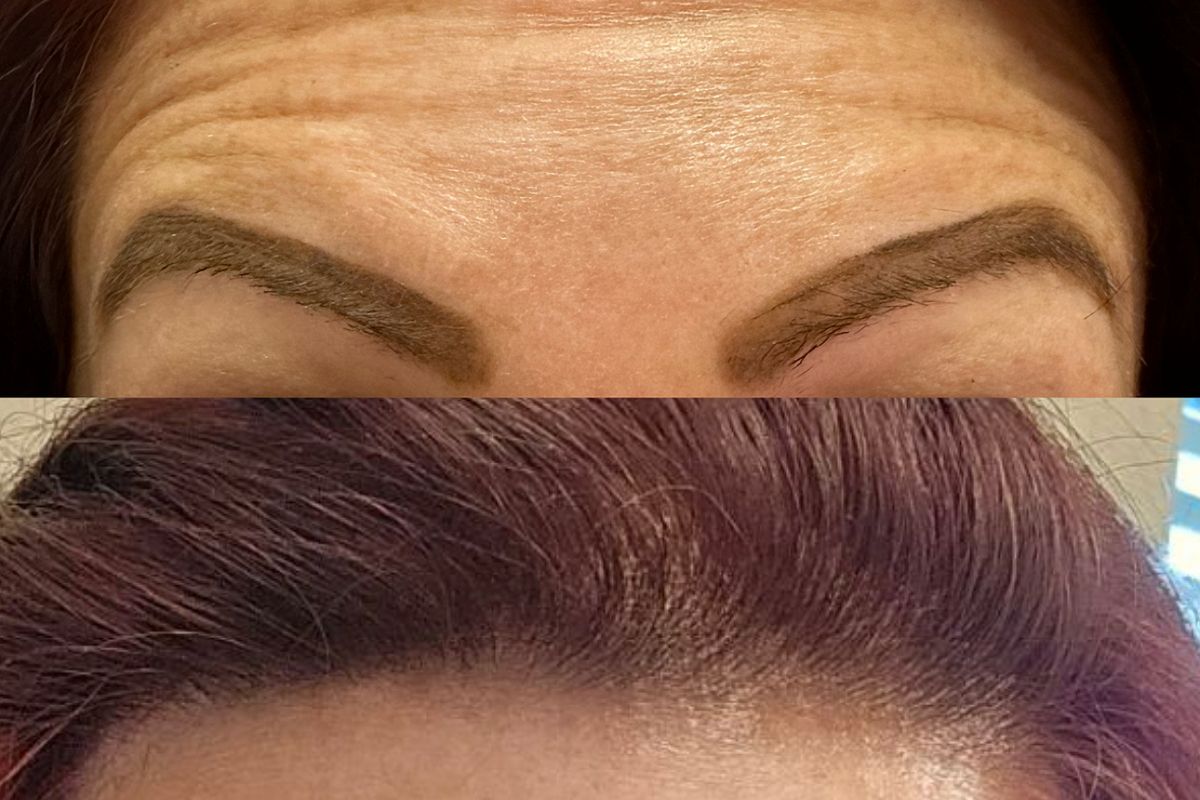 Texas Needle Queen • Botox & Lip Filler Clinic | Round Rock, TX, med spa and aesthetic clinic in Round Rock