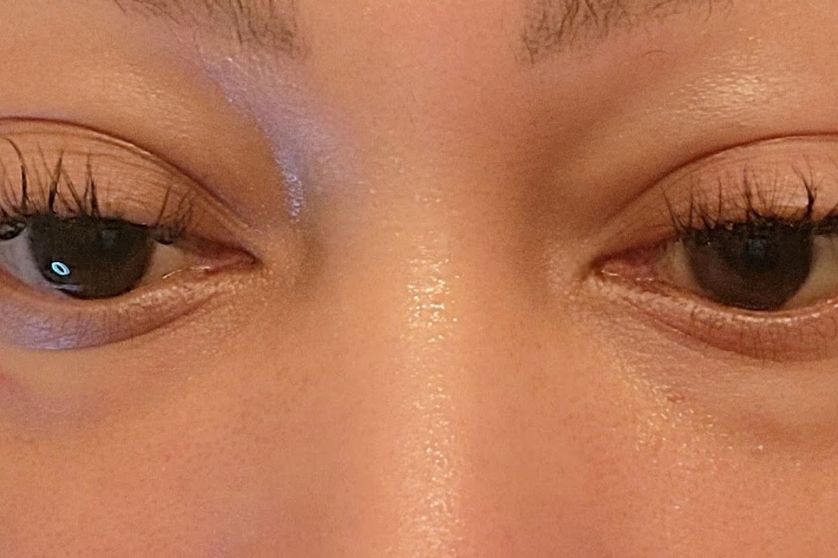 Top Aesthetics Laser, med spa and aesthetic clinic in White Plains