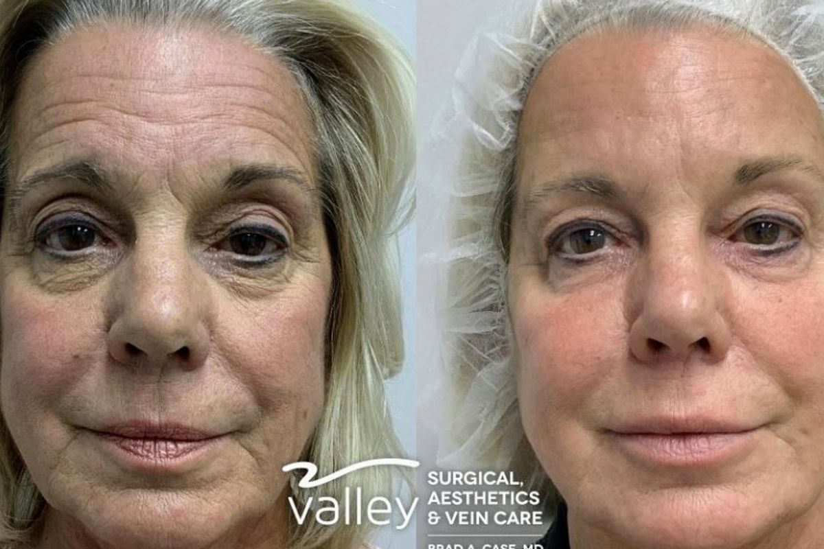 Valley Surgical, Aesthetics & Vein Care:Dr. Brad Case, med spa and aesthetic clinic in Grand Junction