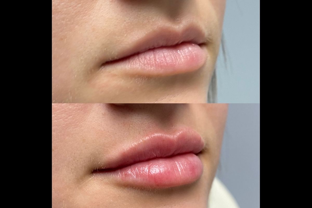 VIO Med Spa | Germantown, med spa and aesthetic clinic in Memphis