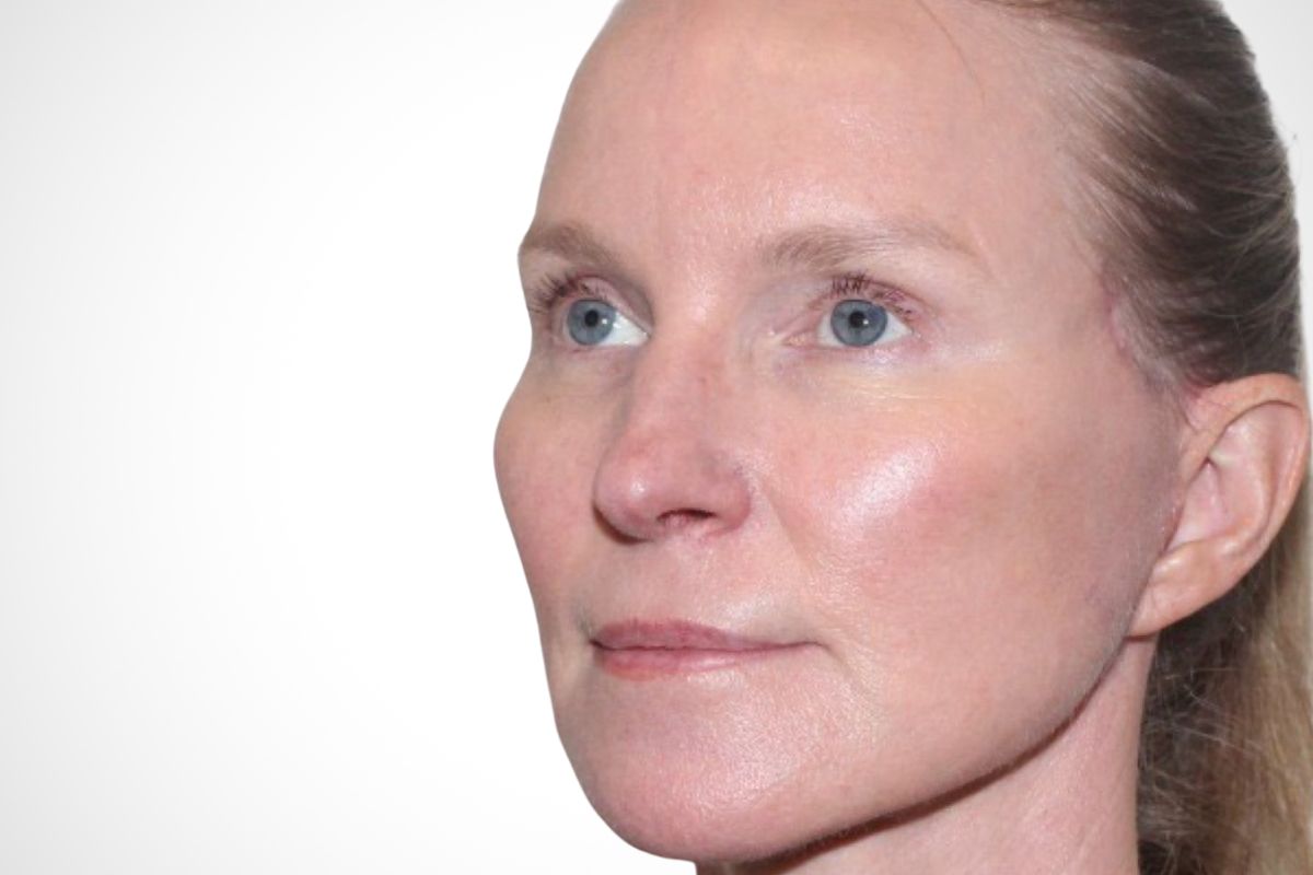 Visage Cosmetic Clinic: Facial Cosmetic Surgery — Winnipeg