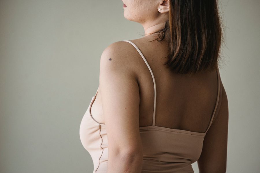 Arm Fat: treatment options