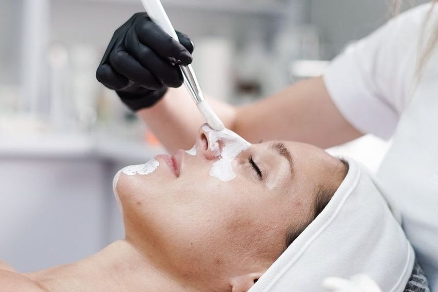 Blackheads: treatment options