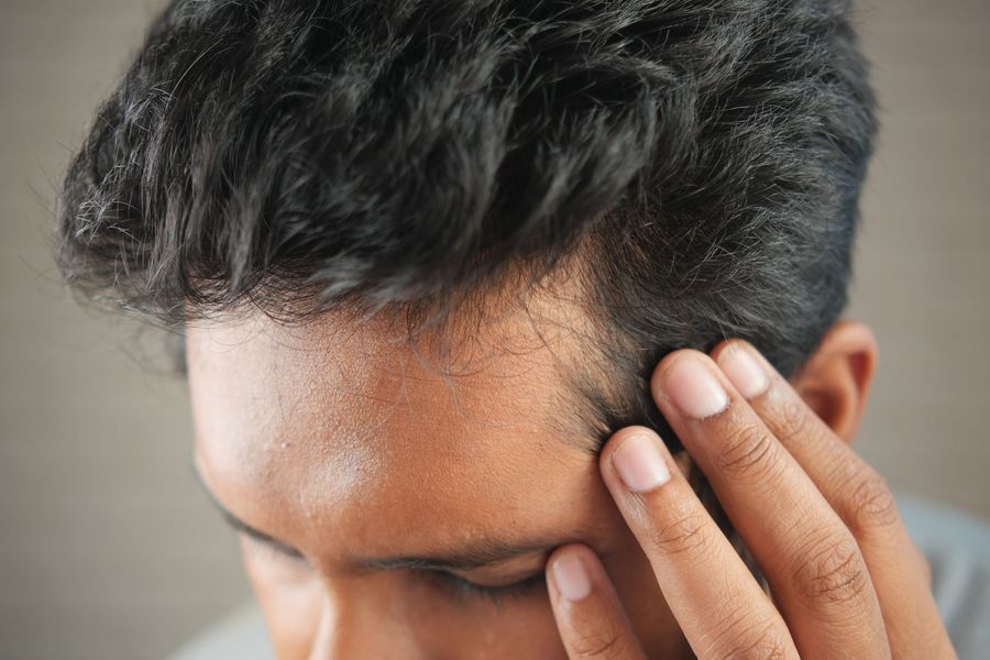 Hair Loss