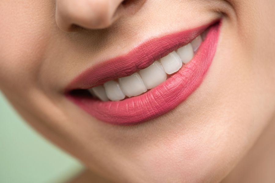 Smile Lines: treatment options
