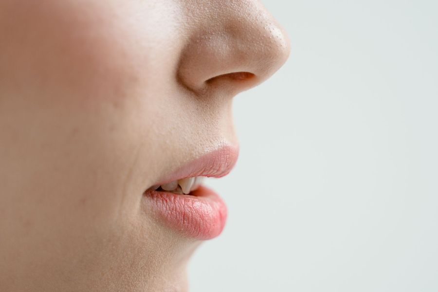 Thin Lips