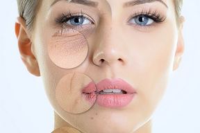 AK Care Medispa | PDO Thread Lift, Lip Nose Fillers, Botox, Liquid rhinoplasty: Brampton, Vaughan, Richmond Hill, Mississauga in Brampton