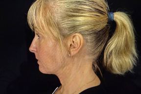 Art Form Plastic Surgery in Clearwater