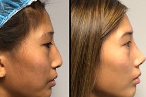 Back Bay Plastic Surgery in Boston