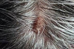 Bay Dermatology in Clearwater