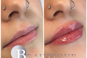 Beautique Med Spa Barrie in Barrie