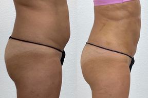 Bella Forme Medical in Chandler