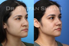 Dallas Facial Plastic Surgery Center in Dallas