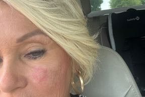 Dermatology Associates of Knoxville - Powell in Knoxville