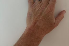 Dr Anzarut Plastic Surgery in Nanaimo