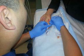 Dr. James M. Lin, MD, Monterey Hand & Orthopedics Expert in Monterey