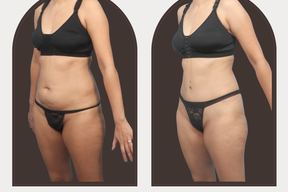 Dr. Lauren Daly, MD in Folsom