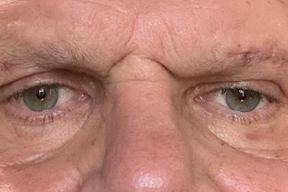 Dr. Steven Leibowitz, MD in Summerlin