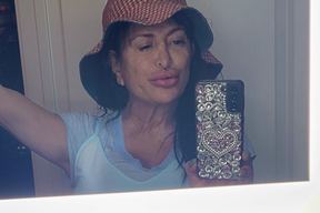 Dr Tantawi Beauty Refined Plastic surgery in Palm Desert