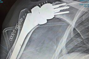 Elliot Orthopaedics in Manchester