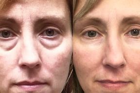 Form Medical Aesthetics in Winnipeg