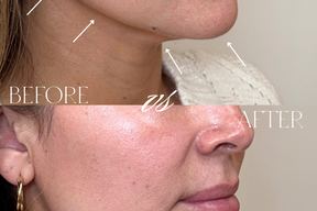 Franco Wellness & Aesthetics - Yuma AZ in Yuma