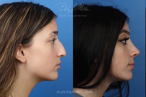 Gotham Plastic Surgery in Manhattan
