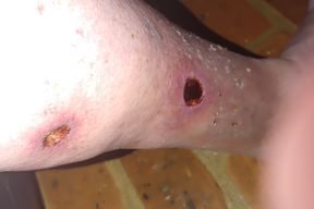 Gulf Surgical Dermatology - Fairhope in Mobile