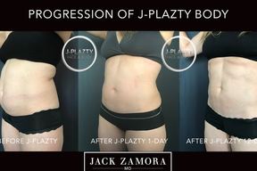 Jack Zamora MD Cosmetic Surgery and Aesthetics in Cherry Creek