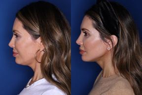 Kalos Facial Plastic Surgery LLC in Buckhead