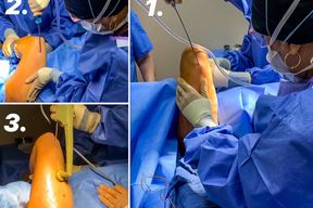Khan Plastic Surgery in Dallas