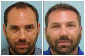 Lam Facial Plastics - Samuel M. Lam, MD, FACS in Plano