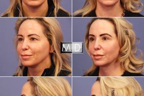 Lemmon Avenue Plastic Surgery and Laser Center in Dallas