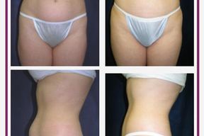 Nashua Plastic Surgery: George P. Chatson, M.D. in Manchester