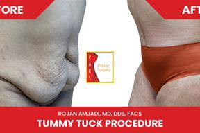 PARS Plastic Surgery in Houston
